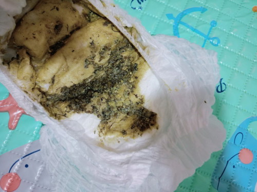 Najis tahi hijau dan bertali