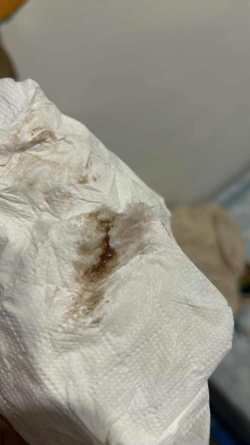 มีมูกเลือดสีน้ำตาลแบบนี้ใกล้คลอดยังค่ะ??