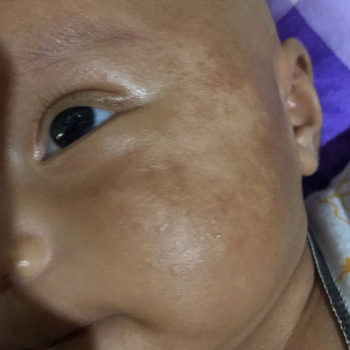 bercah putih di pipi