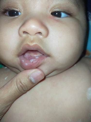 Bibir baby putih .