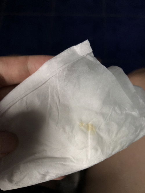 Darah atau keputihan?