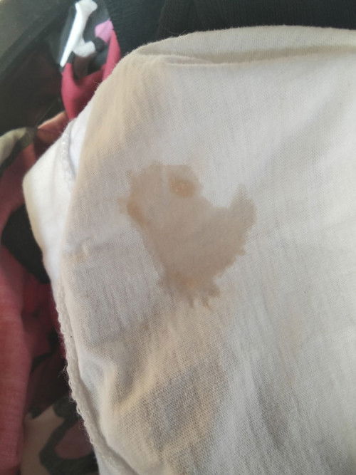 ตอนนี้36+2week