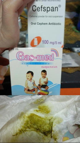 การขับถ่าย
