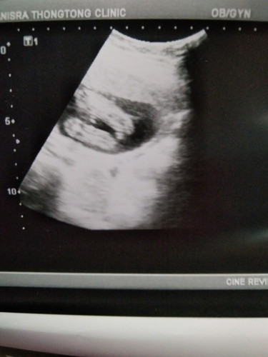 อยากให้แม่ช่วยดูแบบนี้ ญ หรือ ช ค่ะ