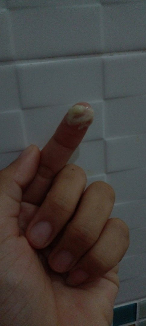 แบบนี้ปกติมั้ยค่ะพึ่ง5เดือนค่ะ