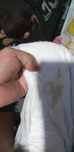 tnong lng ng primerose ako na ksi payo ng ob ko den ngyon my blood n ak sa diaper ko discharge brown