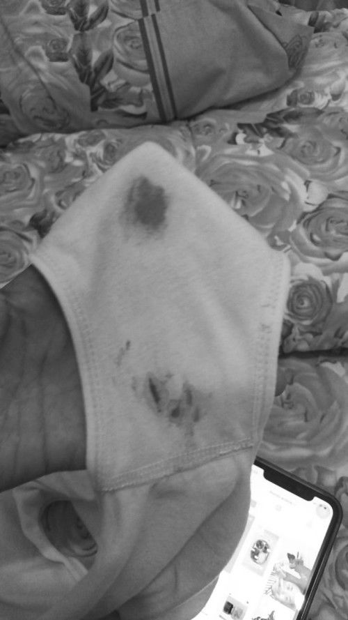 Keluar flek/bercak darah