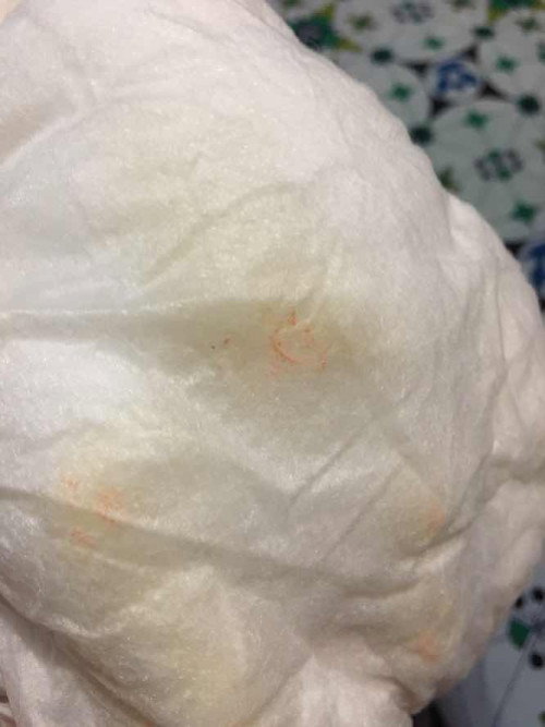 Bercak orange di pampers