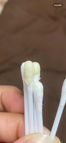 ตกขาวไม่หาย