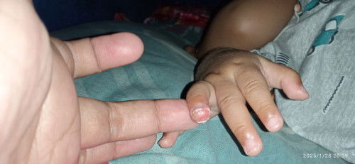 Bun jari bayi saya gatal kaya gitu kira " Apa yaa salep yang ampuh