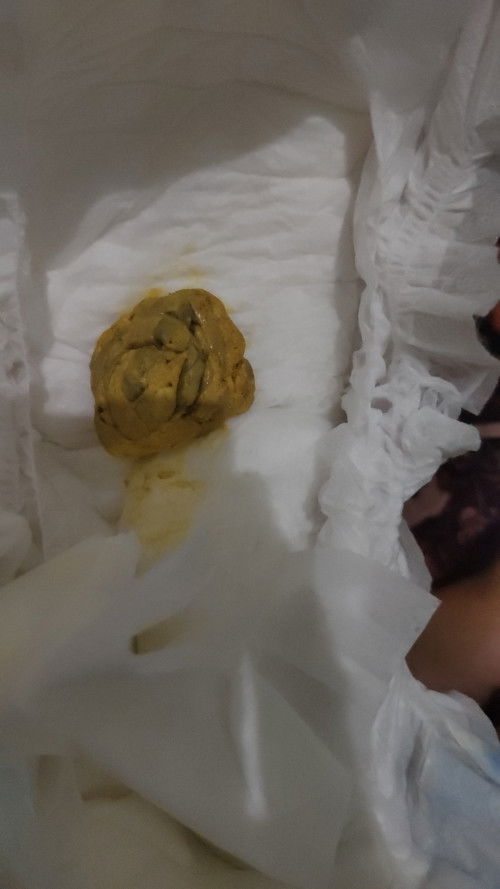 Bun, BAB bayi usia 2 bulan seperti ini aman gak bun??