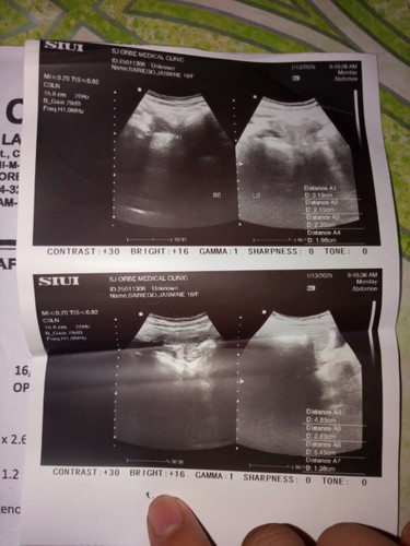 Ask kolng po ganto poba yung 3 months and 4 weeks kse po d Makita Yung baby eii
