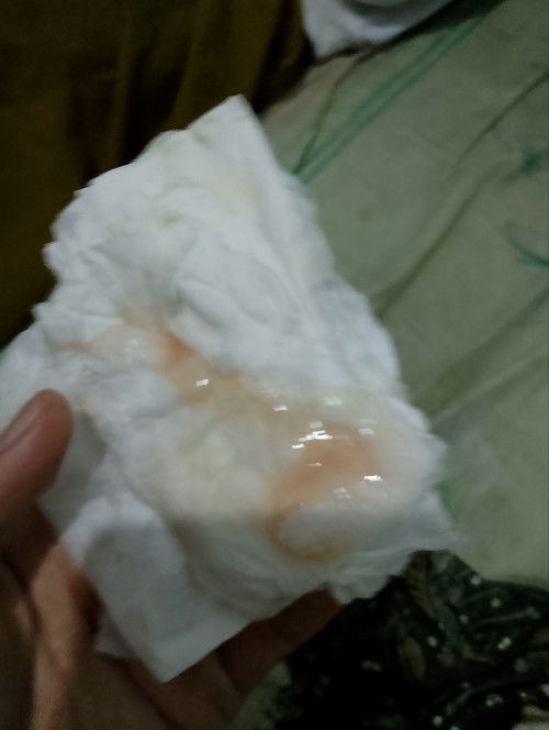 Keluar lendir bercak darah