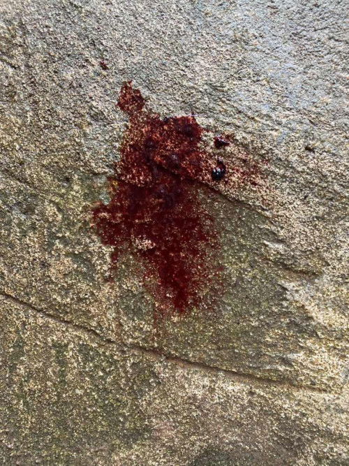 ท้อง8สัปดาเลือดออกเเบบนี้จะเป็นไรมั้ยค่ะ