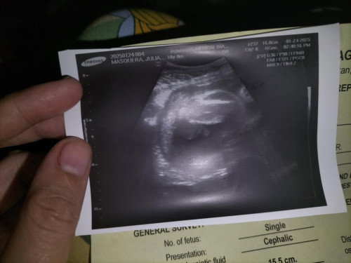 Ultrasound