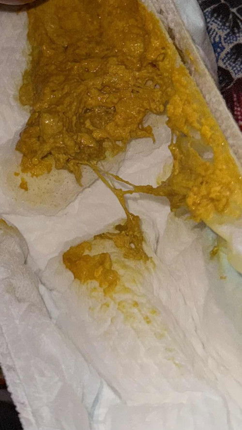 Pup bayi full asi 1 bulan 13 hari