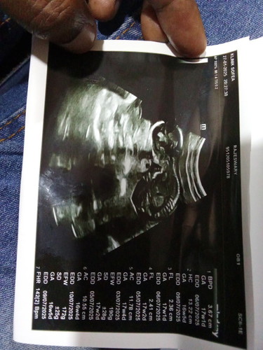 Nak tanye sy pregnant kandungan ke 6. sblm2 ni semua girl2 yg ni sy rasa pregnant tu 17week bru tau