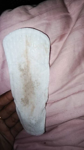 ปกติไหมคะตอนนี้36+4วีค