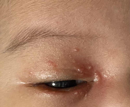 Is it allergic to dust or milk?