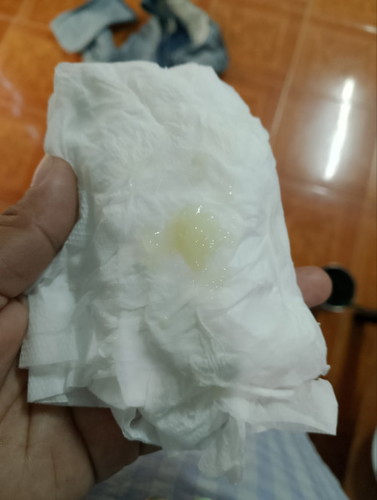 แบบนี้ใช่มูกไหมค่ะ