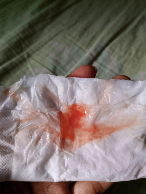 dari tanggal 29 keluar lendir darah campur keputihan