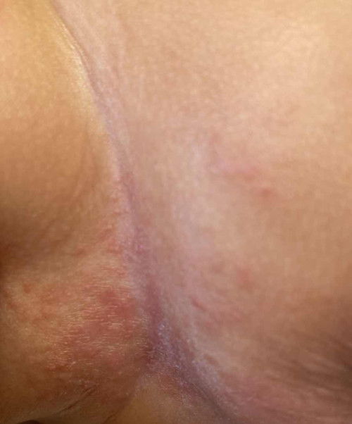 ขอคำแนะนำจากแม่ๆหน่อยค่ะ