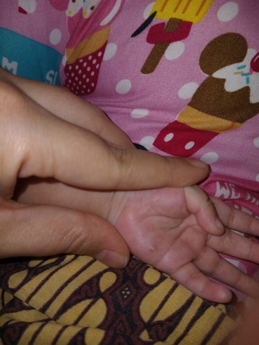 Tangan bayi bintik kaya ada airnya itu kenapa ya bunda bunda , terus obatnya apaa ya