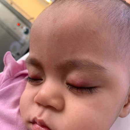 Mata baby kenapa