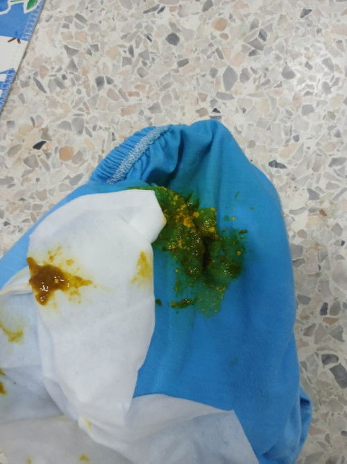 สอบถามหน่อยค่ะแม่ๆ ลูกอายุ3เดือนกินนมแม่ล้วนอึแบบนี้ปกติไหมคะ