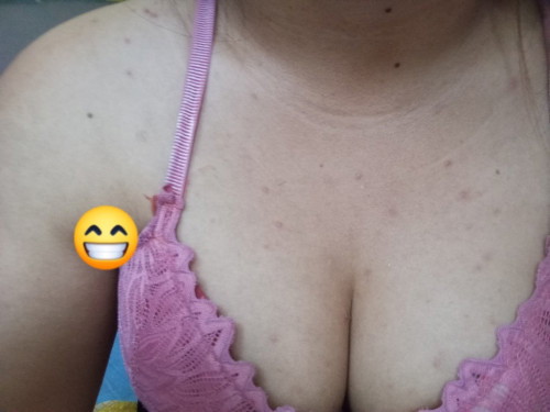 ตอนนี้แม่ท้องได้9วีคแล้วมีตุ่แดงๆขึ้นตามหลังและหน้าอกเต็มไปหมด อยากรู้ว่าแบบนี้ปกติไหมคะ