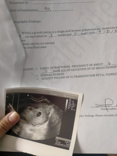 May same case poba ako gs palang nakikita 6weeks pregnant
