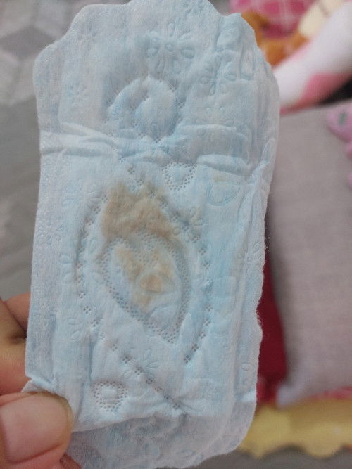 Flek kecoklatan,apa tanda mau lahiran?