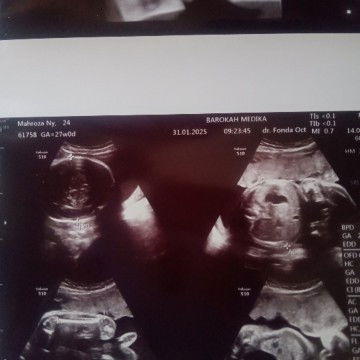 Kira" laki atau perempuan ya bund , kata dokter sih laki. Disuruh balik lagi bulan depan