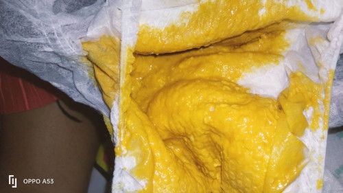 ถ่ายแบบนี้ปกติไหมค่ะ