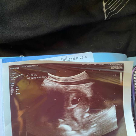 ขอสอบถามแม่ๆหน่อยค่ะ แม่ๆตรวจเจอกตัวอ่อนน้องตอนกี่สัปดาห์คะ หนูตรวจตอน6สัปดาห์2วันยังไม่เจอตัวอ่อนน้องเลยค่ะ