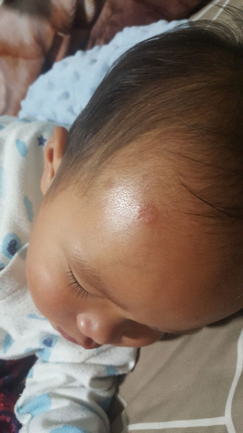 ลูกเป็นแบบนี้คือเกิดจากอะไรค่ะ