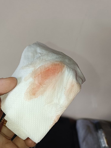 apa ka ini flek?