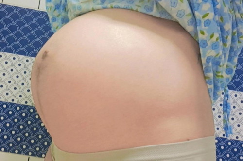 29+4w มีแต่คนทักว่าท้องแหลม ท้องเล็ก จะมีผลอะไรกับน้ำหนักหรือตัวลูกไหมคะ