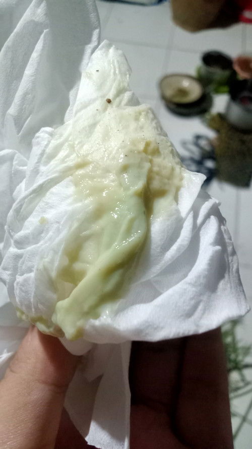 Keputihan diusia 34minggu