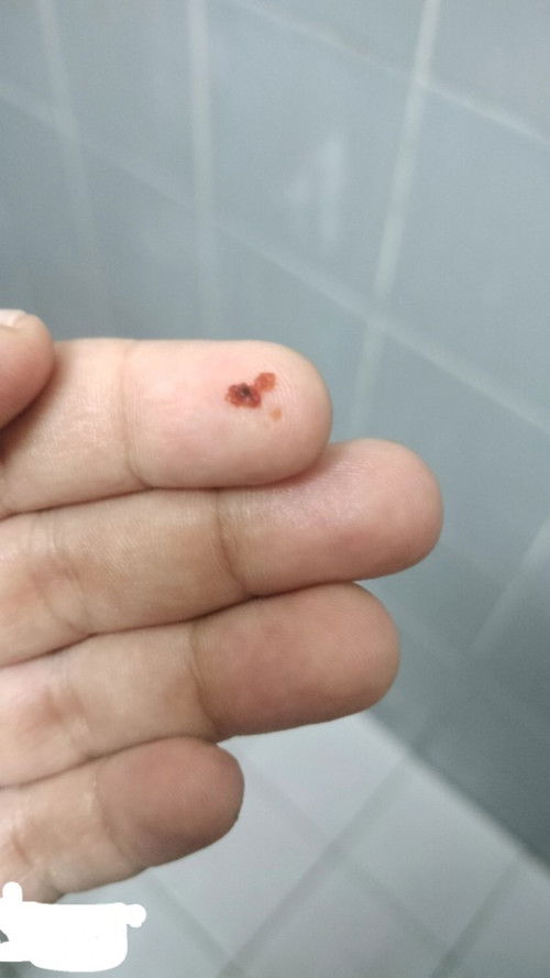 Siapa ada pengalaman waktu 4weeks mcm ni