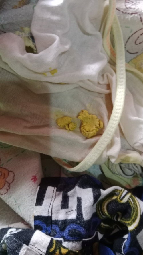 Pup bayi 1 bulan normal ga