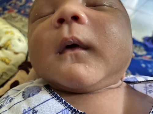 Bibir nya seperti kering itu apa normal ya?