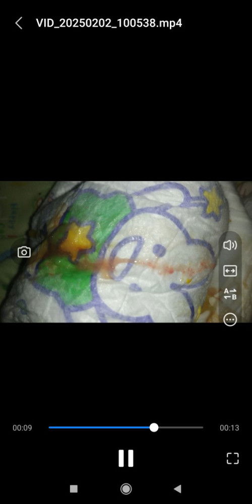 Bayi usia 3 BLN 26 hari, stelah bab keluar sperti ada bercak merah dicampur seperti lendir,tdk diare