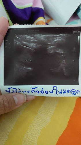 ขอสอบถามแม่ๆหน่อยนะค่ะ เจอน้องตอนกี่สัปดาห์ค่ะ