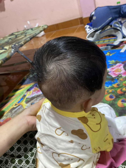 แบบนี้หัวน้องแบนไหมคะแม่ๆ น้อง 6 เดือนค่ะ
