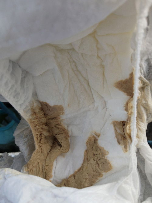 น้องขี้แบบเป็นอะไรหรือเปล่าคะ