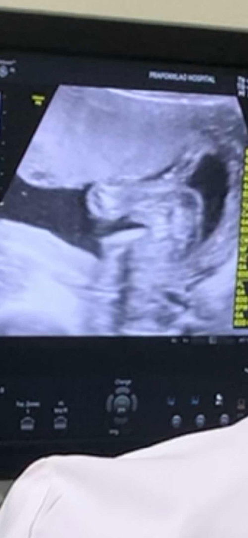 แบบนี้แม่ๆคิดว่าผู้หญิงหรือผู้ชายคะ