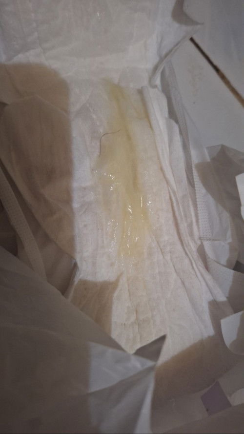 Keluar lendir tanpa ada rasa kontraksi/mules