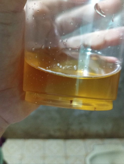 Urine ada darahnya