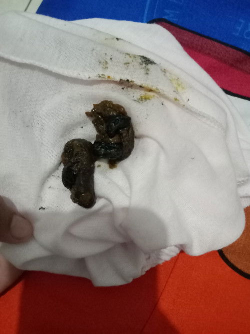 Bab bayi 6 bulan setelah MPASI